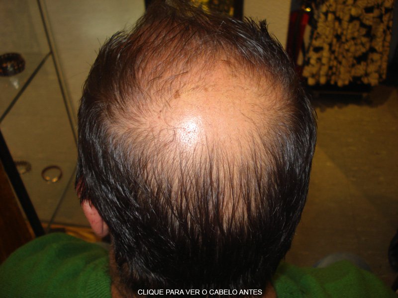 Cabelo depois